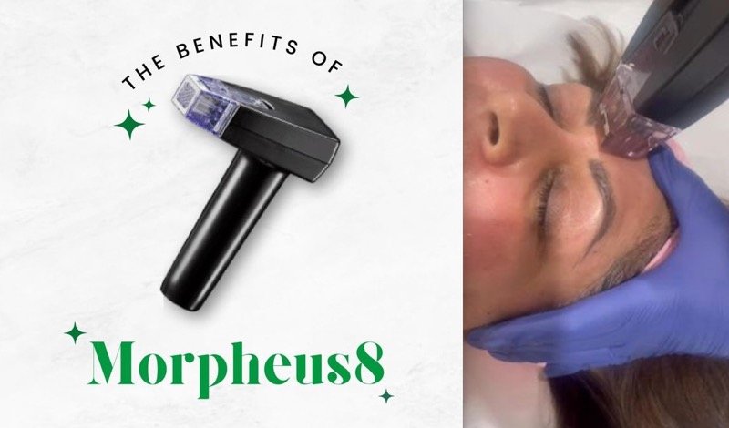 Factores de coste del tratamiento Morpheus8