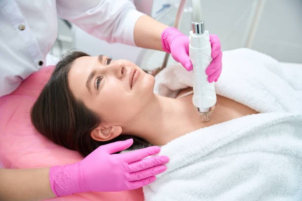 about Rf microneedling before and after