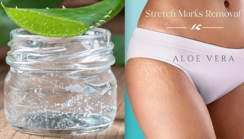How to Remove Stretch Marks Aloe Vera: The Soothing Gel 